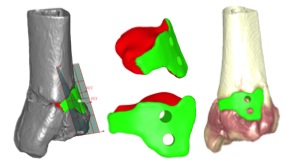 Rapid manufacturing bone implants